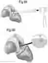 Fig. 10 - Optimized solid substrates, tools for use with same and uses thereof for promoting cell and tissue growth