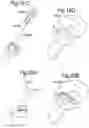 Fig. 25 - Optimized solid substrates, tools for use with same and uses thereof for promoting cell and tissue growth