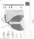 Fig. 06 - METHOD FOR OPERATING A VENTILATOR FOR ARTIFICIAL VENTILATION OF A PATIENT, AND SUCH A VENTILATOR