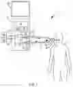 Fig. 02 - Lung recruitment in mechanical ventilation