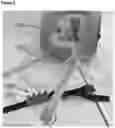 Fig. 09 - TUBE FASTENER DEVICE