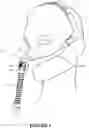 Fig. 03 - NASAL SEAL AND RESPIRATORY INTERFACE