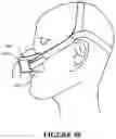 Fig. 34 - NASAL SEAL AND RESPIRATORY INTERFACE