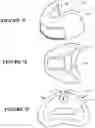 Fig. 44 - NASAL SEAL AND RESPIRATORY INTERFACE