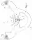 Fig. 08 - Positive-air-pressure machine conduit