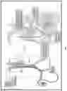 Fig. 02 - PERCUTANEOUS PULMONARY ARTERY DRAINAGE DEVICE