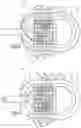 Fig. 03 - Implantable intracranial pulse pressure modulator and system and method for use of same