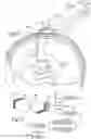 Fig. 06 - Implantable intracranial pulse pressure modulator and system and method for use of same