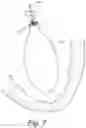 Fig. 09 - Heart support device with directional flow assist