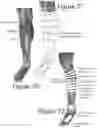 Fig. 33 - METHODS AND APPARATUS FOR A WEARABLE ELECTRONIC DIGITAL THERAPEUTIC DEVICE