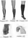 Fig. 68 - METHODS AND APPARATUS FOR A WEARABLE ELECTRONIC DIGITAL THERAPEUTIC DEVICE
