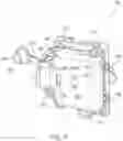 Fig. 06 - Electrical connector and cover for simultaneously connecting wires, bedside monitor, and temporary pacemaker