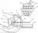 Fig. 01 - Brachytherapy treatment planning system