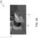 Fig. 22 - SYSTEM AND METHOD FOR VESTIBULAR ASSESSMENT AND REHABILITATION