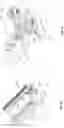 Fig. 07 - Trocar needle grinder