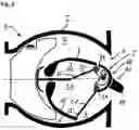 Fig. 04 - Air vent