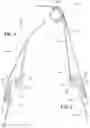 Fig. 07 - ZIPPER LESS REMOVABLE WINDOWS FOR A FOLDING SUV SOFT TOP