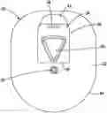 Fig. 01 - Child resistant dial pack