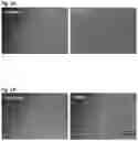 Fig. 02 - METHOD TO GENERATE INDUCED OLIGODENDROCYTE-LINEAGE CELLS AND TREATMENT USING SUCH CELLS