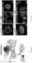 Fig. 46 - CELL POPULATIONS AND GENE EXPRESSION ASSOCIATED WITH IN VITRO BETA CELL DIFFERENTIATION