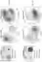 Fig. 53 - CELL POPULATIONS AND GENE EXPRESSION ASSOCIATED WITH IN VITRO BETA CELL DIFFERENTIATION