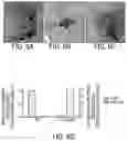 Fig. 07 - RAAV-based compositions and methods for treating amyotrophic lateral sclerosis