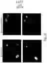 Fig. 22 - RAAV-based compositions and methods for treating amyotrophic lateral sclerosis