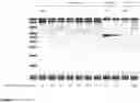 Fig. 03 - MATERIALS AND METHODS FOR MODULATING INTRAOCULAR AND INTRACRANIAL PRESSURE