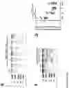 Fig. 12 - MATERIALS AND METHODS FOR MODULATING INTRAOCULAR AND INTRACRANIAL PRESSURE