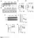 Fig. 14 - MATERIALS AND METHODS FOR MODULATING INTRAOCULAR AND INTRACRANIAL PRESSURE