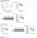 Fig. 15 - MATERIALS AND METHODS FOR MODULATING INTRAOCULAR AND INTRACRANIAL PRESSURE