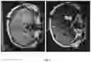 Fig. 06 - Methods utilizing leukocyte RNA expression in prognosis evaluation of medical interventions for epilepsy
