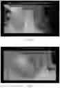 Fig. 09 - Method for the Removal and Recovery of Metals and Precious Metals from Substrates