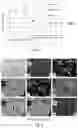 Fig. 04 - WEAR-RESISTANT IRON-BASED ALLOY COMPOSITIONS COMPRISING NICKEL