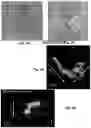 Fig. 08 - METHODS AND DEVICES FOR MAKING NANOFIBERS AND NANOFIBER SCAFFOLDS
