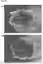 Fig. 35 - Graphene fiber and method of manufacturing the same