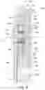 Fig. 07 - Device for hydraulically operating a drive wheel of a wellbore tractor, e.g. a motor, and related tractor, wellbore string, and method