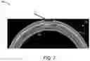 Fig. 08 - Quick connect for conduits