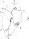 Fig. 08 - Brake mounting bracket