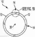 Fig. 01 - Radial seal segment joint