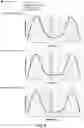Fig. 06 - Light projecting device