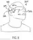 Fig. 05 - EYEWEAR DESIGN WITH TEMPLE RETENTION FEATURES