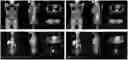Fig. 01 - Method and system for generating composite PET-CT image based on non-attenuation-corrected PET image