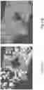 Fig. 43 - Systems and methods for imaging samples with reduced sample motion artifacts