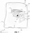 Fig. 02 - Lateral canthotomy and cantholysis simulation device