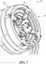 Fig. 08 - End shield with spray feature