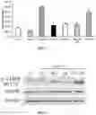 Fig. 02 - Methods and compositions comprising ursolic acid and/or resveratrol for treating diabetes, or cancer