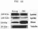 Fig. 08 - METHOD FOR DETERMINING DECREASE IN FUNCTIONS OF HIPPOCAMPUS BY USING CORRELATION BETWEEN MICRO RNA AND NMDA RECEPTOR, METHOD FOR INHIBITING DECREASE IN FUNCTIONS, AND METHOD FOR SCREENING FOR INHIBITORS OF DECREASE IN FUNCTIONS