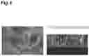 Fig. 09 - Radiation detector and method for manufacturing radiation detector
