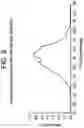 Fig. 09 - SOFT CONTACT LENS WITH NEW STABILIZATION ZONES FOR IMPROVED ANGULAR STABILITY AND COMFORT